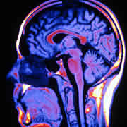 exposition Le cerveau intime - Tête humaine en image de synthèse