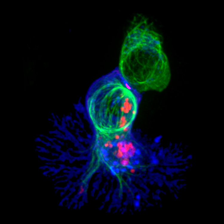 Un lymphocyte T tueur (en bleu) s'apprête à détruire sa cellule cible (en haut, en vert) grâce à des granules toxiques (rouges).