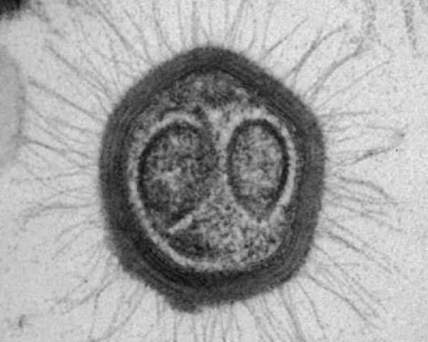 Mimivirus