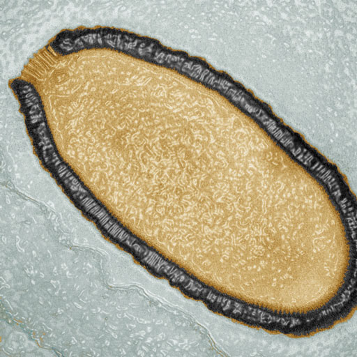 Pithovirus Sibericum, vieux de plus de 30 000 ans