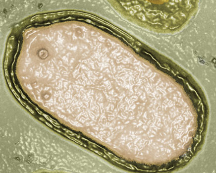Pandoravirus