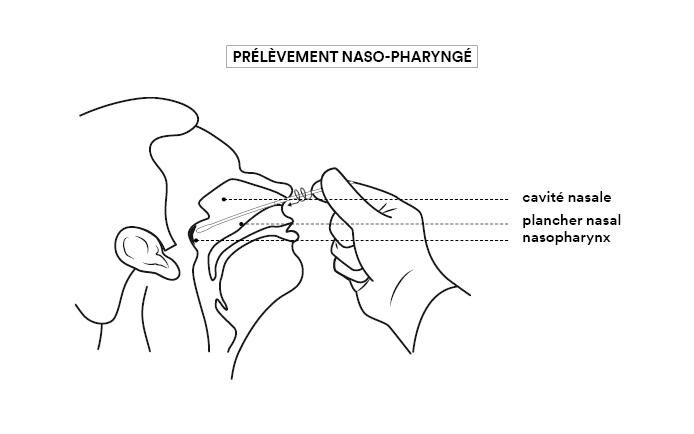 Prélèvement naso-pharyngé (légendes : cavité nasale, plancher nasal, nasopharynx)