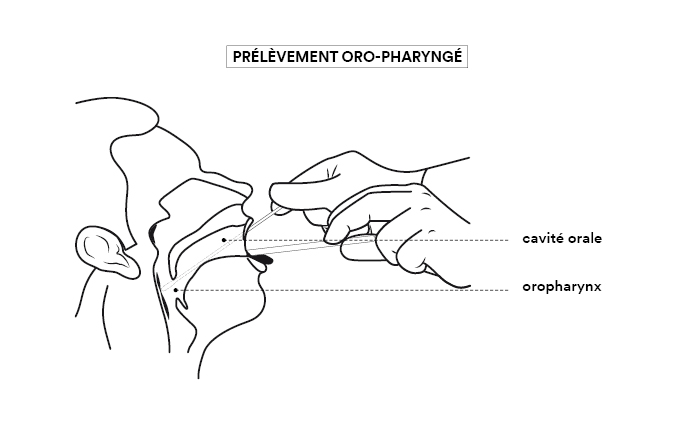 Prélèvement oro-pharyngé (légendes : cavité orale, oropharynx)