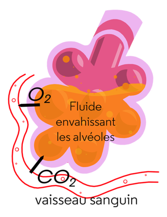 alvéole2_2.png